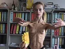 Anorexic Inna 22